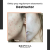 SkinTra - Destructor - Całoroczny Peeling Kwasowy 24% - 100ml