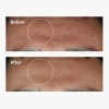 The Ordinary - Niacinamide 10% + Zinc 1%  - Serum z Witaminą B3 i Cynkiem - 30ml