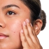 The Ordinary - Salicylic Acid 2% Solution - Serum z Kwasem Salicylowym - 30ml