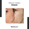 SkinTra - Eraser - Serum na Przebarwienia z Witaminą C 10% - 30ml 
